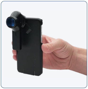 Dermoscope Dermoscope